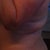 Before - lumps of fat at the bra line is what bothered me the most.  You can see a faint scar on my hips from a previous surgery