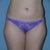 before front