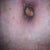 Here is my belley button looking alot better