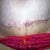 this is how myb wounds look now....