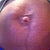 Front View of my stomach