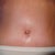 04/26/13-PO 3 WEEKS-belly button