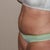 12 Days Post Op