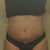 3 weeks post!
