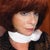 One week later - I'm back at work with some concealer and a scarf to cover the bruising.  Had the procedure on Thursday afternoon and went back to work on the following Thursday morning.  Amazing!