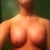 6 weeks post op
