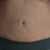 6 weeks post