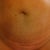 before of my tummy. The blobb .....I mean, I work out, TRY to eat helthy, but this never went away!