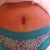 Still some puffiness and two bandages from drains. BUT, I have a flat tummy! OMG