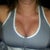 Day 5 Post op. 457 cc Allegan gel implants under the muscle.