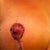 nipple right after removing steri strips