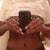 3 months post op