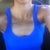2 wks 1 day PO. Sitting in my car....Yay, No bulge:)!