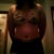 3 weeks post op