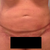 Front view - day 3.