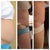 Before, at 2 wks and 3 wks
