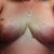 3 weeks.  Lefty is still a bit more swollen than righty and the bruising on righty is much better.  I am seeing alot of yellow now and hopefully by next week most of that will be gone.