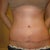 4 weeks- incision