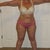 Before Front Inner, outer thighs, knees, calves and ankles 12/12