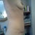 3 months No more tummy skin bulge!
