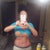 6 weeks post op. Still swelling on hips where lipo was done