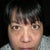About a few weeks after injection. Again no make up in natural lighting.