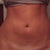 Exactly 8 weeks post- just started to notice it smoothing out :)