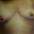 This was me, before I had any surgeries.  What I would give to go back in time.