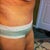 2 weeks po not very good a taking pic myself