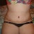 these pics were taken at night and swelling is worse at night