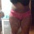 3 months post surgery - I tried to lighten the picture