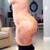 5 days post-op (super swollen w/o garment for 4 days =( Back scoop VERY swollen. Triangle was only in place w garment for 24 hrs.
