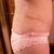 Right hip not as raised
