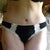 tummy tuck 5 weeks post op