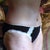 Tummy Tuck 10 weeks post op