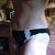 Tummy tuck 10 weeks post op