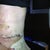 Day 4, post op