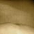 this is my least favorite scar...it's from a laparoscopic cholecystectomy 21 years ago...it's a few inches above my belly button and it causes a weird wrinkle/roll there!  i am hoping it can be dragged down to become the edge of my new belly button!
