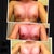 Day 1 PO..week 1 PO..week 2 PO..week 3 PO from top to bottom