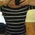 7 weeks post op. This dress is tight and looking right! Haha