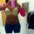 Seven weeks post op