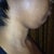 BEFORE CHIN
