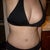 Belly button scar is lightening up