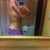 9 hours post op
