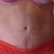 Thoughts on the spot under my bb?  Is it getting smaller?