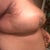 Anyone else have side armpit jowls? The big swollen flaps under my arms are way strange.
