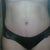 4 wks PO.  This body hasn't seen any kind of a 2 piece bathing suit - not even a tankini - in over 20 yrs!  But I could do it!