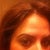 Day 6, my skin has that bumpy texture still