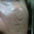 before picture of the right