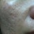 before pic of the left